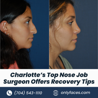 Top-Nose-Job-Surgeon-onlyfaces.png