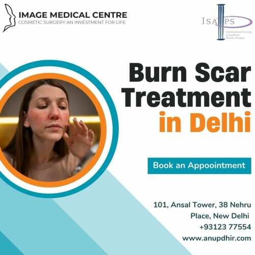 Burn Scar Treatment in Delhi Dr. Anup Dhir