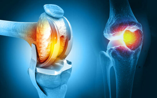 joint-replacement-surgeon-in-delhi-ncr..jpeg