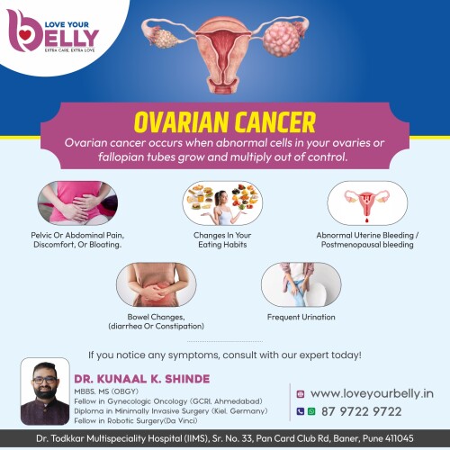 Ovarian-Cancer.jpeg