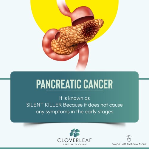 Pancentric Cancer