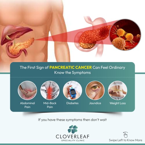 Pancentric Cancer2