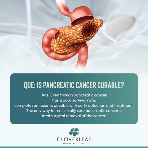 Pancentric Cancer4