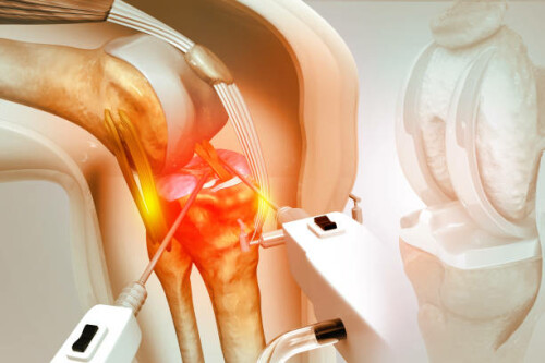 Dr. Atul mishra is the best knee replacement surgeon in Delhi NCR, known as master of Orthopedic at asic clinic for the best knee replacement surgery in Delhi NCR