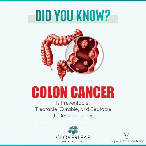 Colon-Cancer.jpg