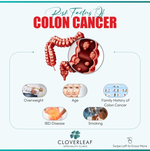 Colon-Cancer3.jpg