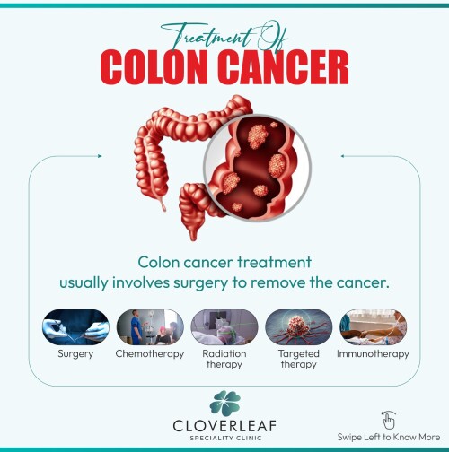 Colon-Cancer4.jpg