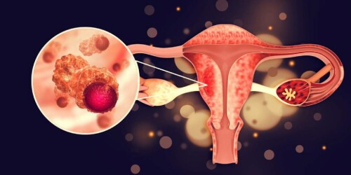 How-Do-I-Know-I-Have-Endometriosis_.jpg