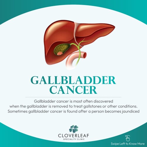 Gallbladder-Cancer.jpg
