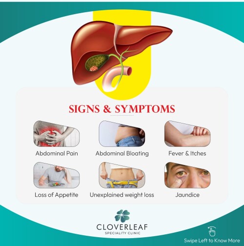 Gallbladder-Cancer1.jpg