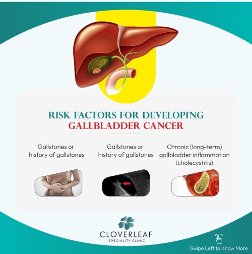 Gallbladder-Cancer2.jpg