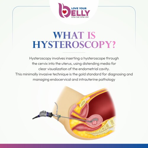 Hystroscopy