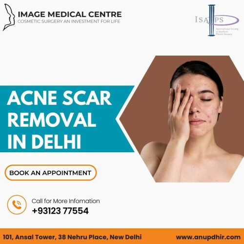 Acne-Scar-Removal-in-Delhi--Dr.-Anup-Dhir.jpg