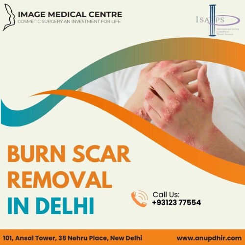 Burn Scar Removal in Delhi Dr. Anup Dhir